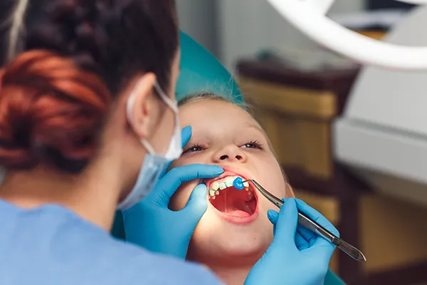 Young white boy patiently keeping his mouth open while his female dental assistant applies fluoride solution to his teeth at D.A. Dental in Auburn, MA